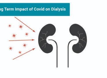 Dialysis treatment | Apollo Dialysis